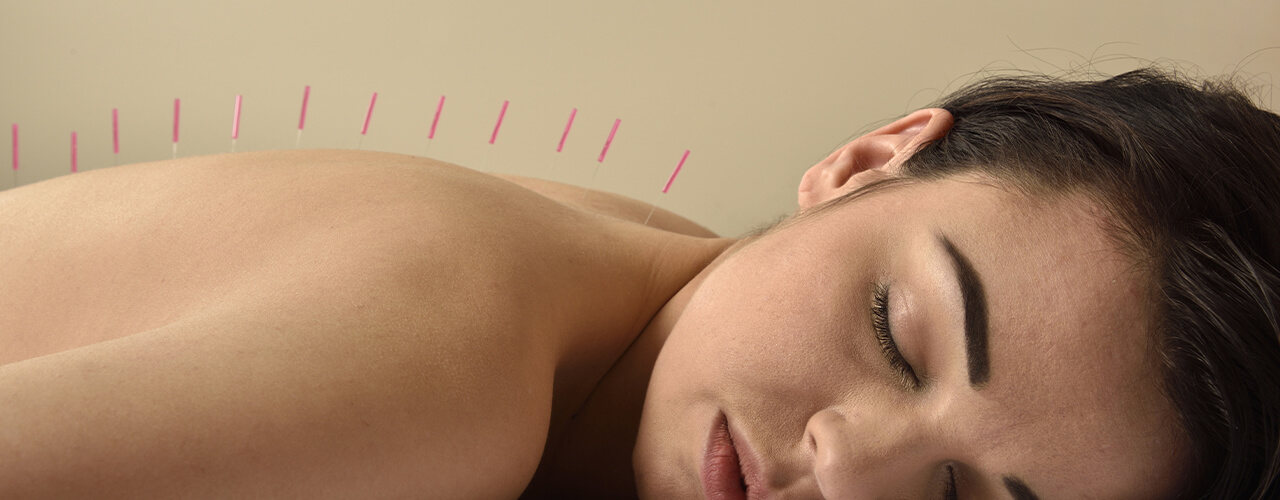 Benefits of Acupuncture