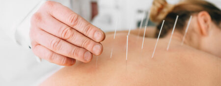Acupuncture Services Victoria, BC