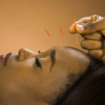 Find True Pain Relief with Acupuncture