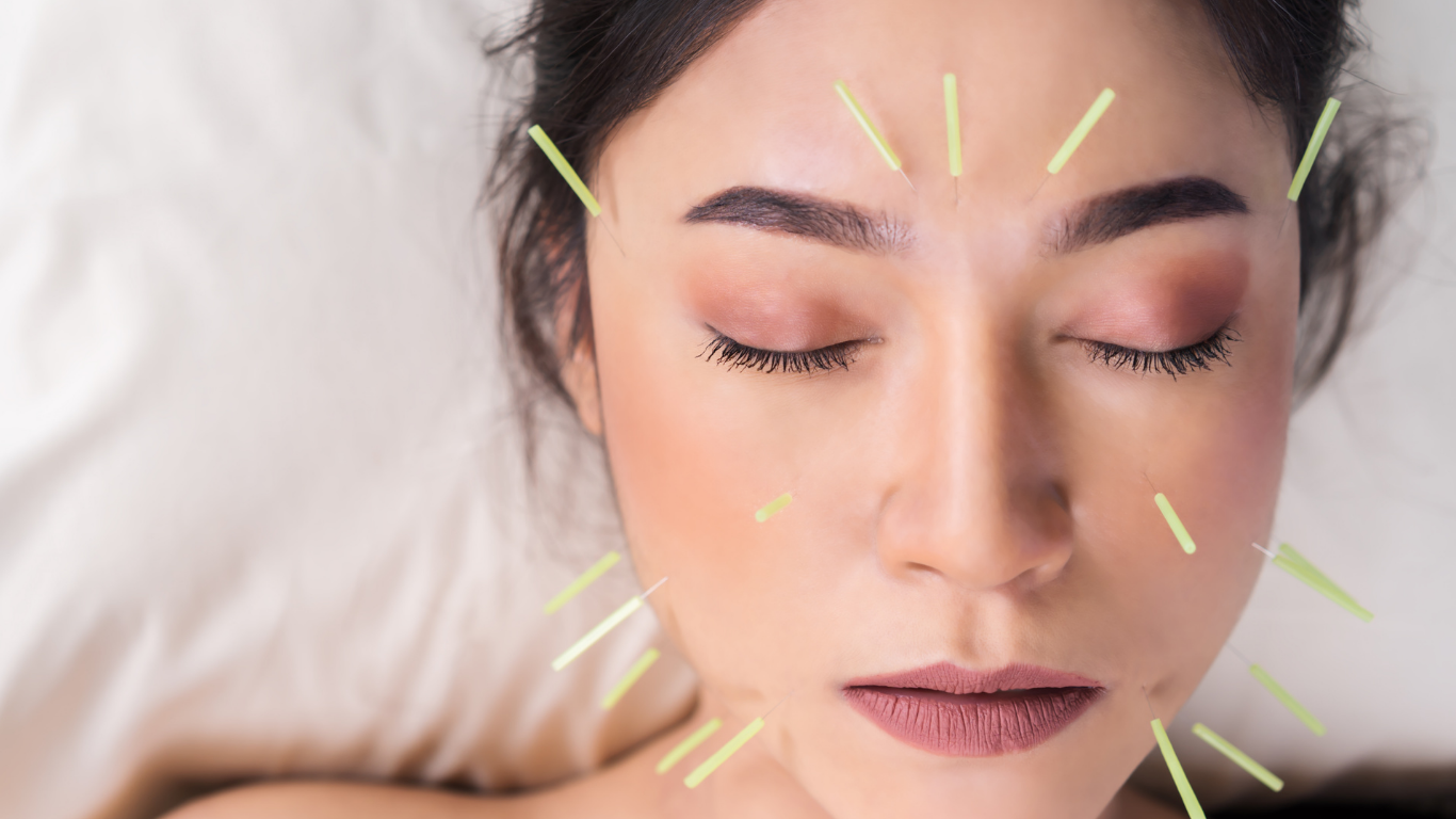 A relaxed woman lies back and receives acupuncture treatment in her face and neck at Equilibrium.