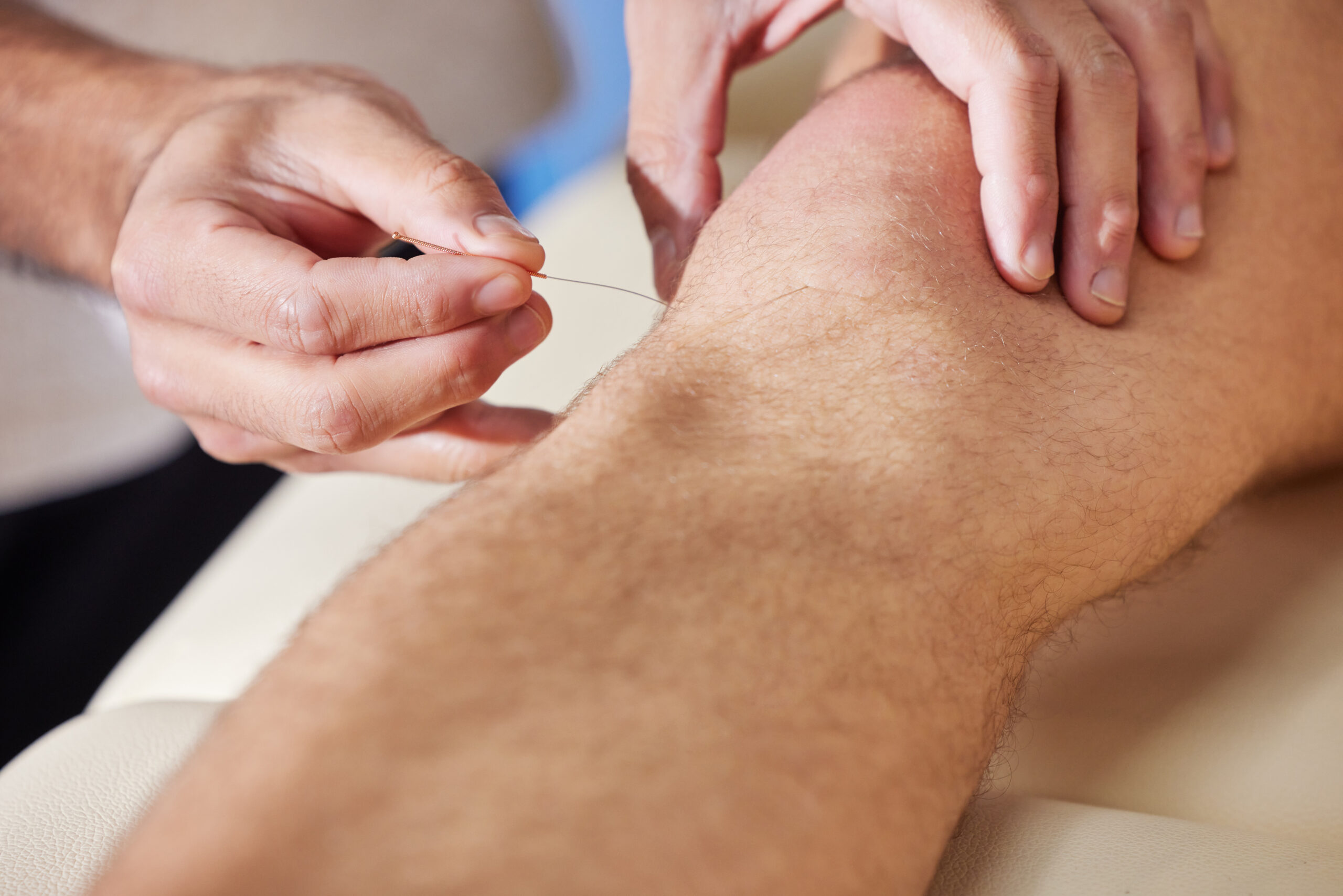 Dry needling in Victoria